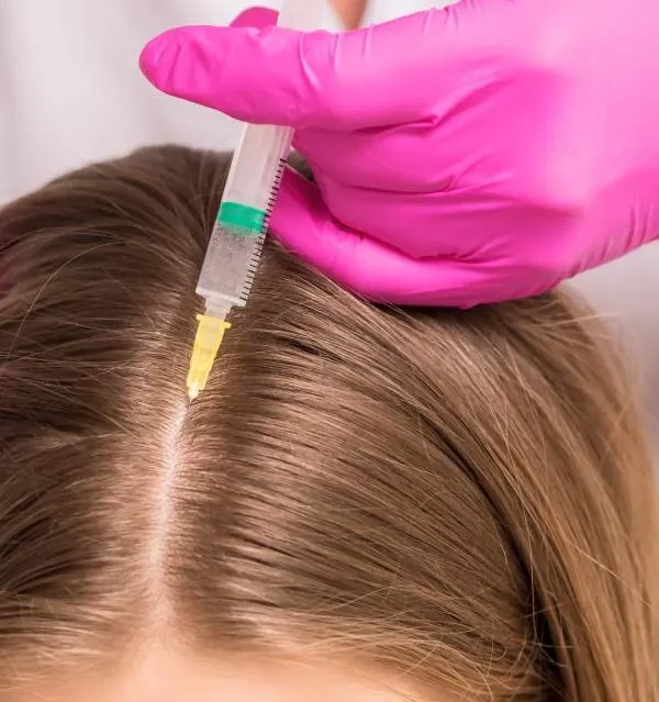Hair Restoration with Stem Cells
