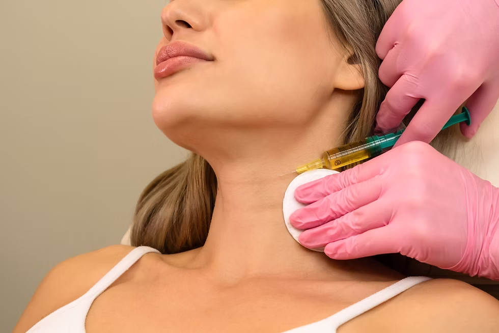 Microneedling con PRP