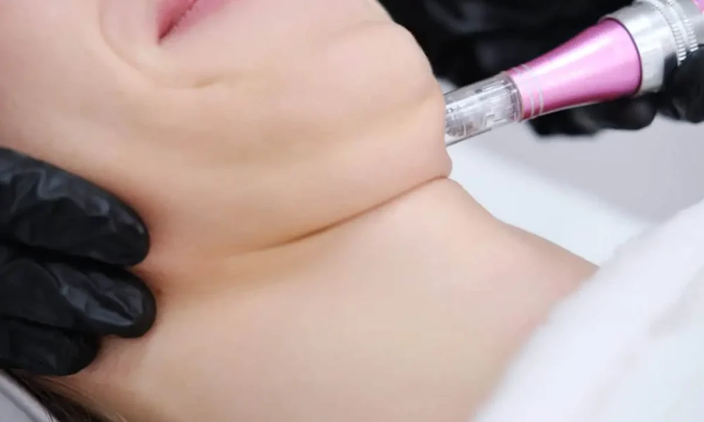 Dimpled chin