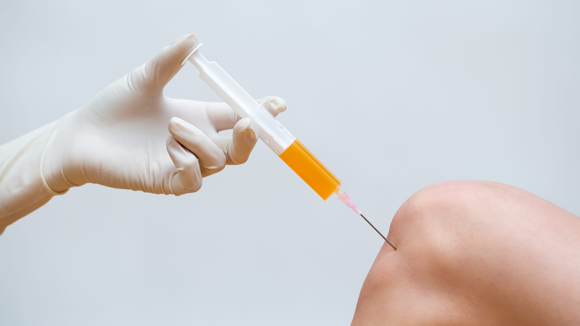 PRP for Joints